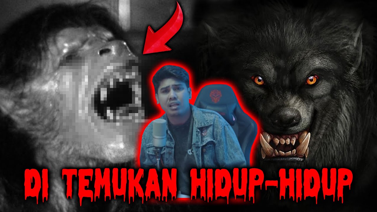 SYNDROME MANUSIA SERIGALA JADI-JADIAN