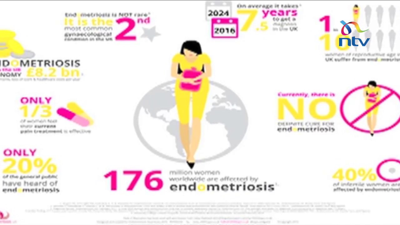 Woman with rare condition of menses through the navel