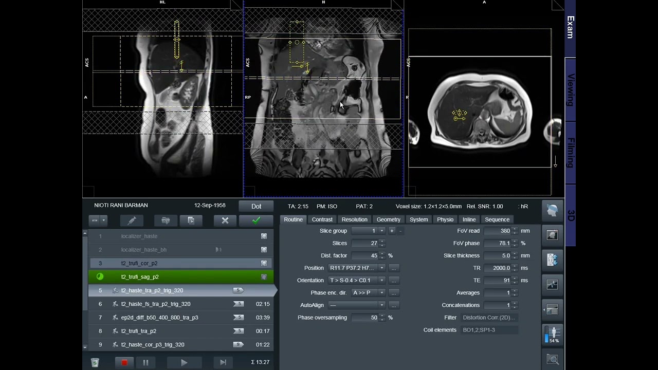 How to MRI of MRCP Planning | SIEMENS 1.5