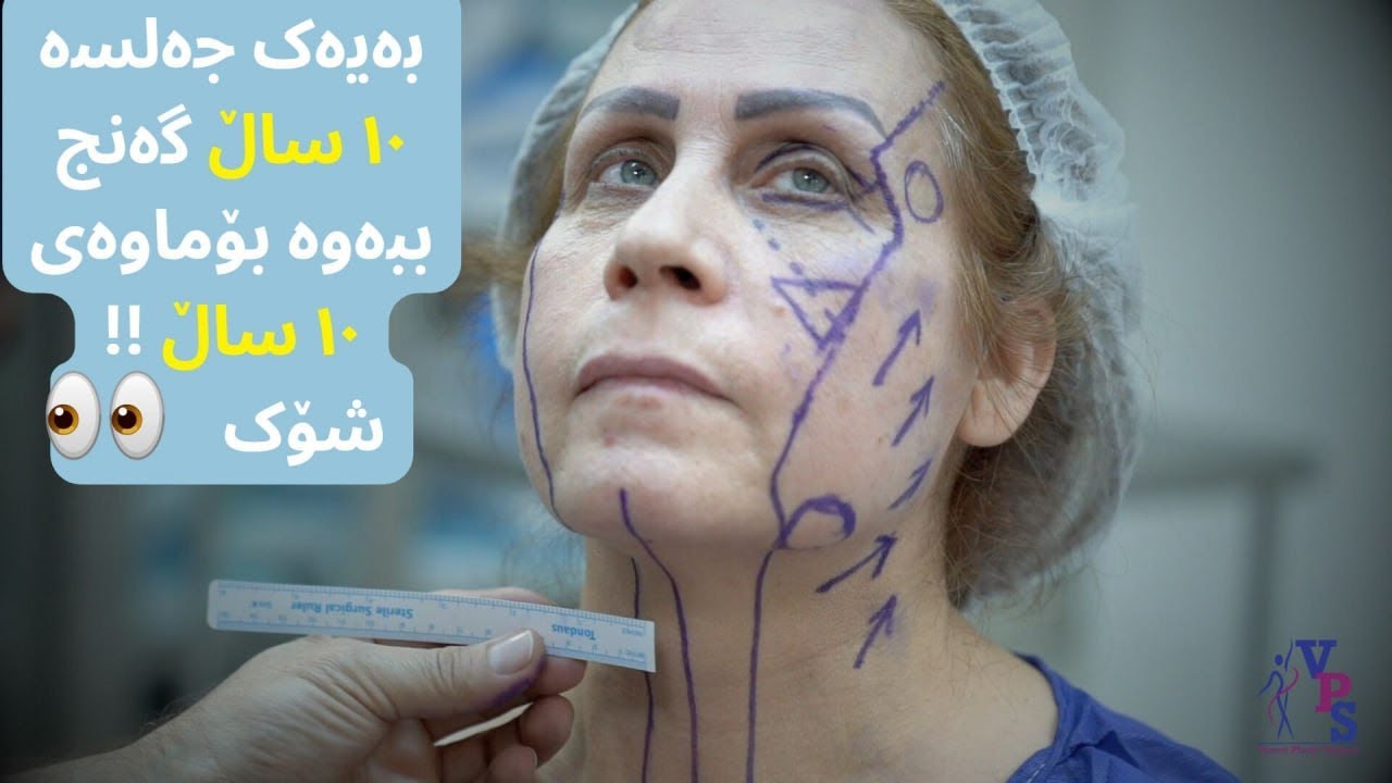 في جلسة واحدة ترجع شابا ١٠ سنوات لمدة ١٠ سنوات!! شوك/ بەیەک جەلسە ١٠ ساڵ گەنج ببەوە بۆماوەی ١٠ ساڵ