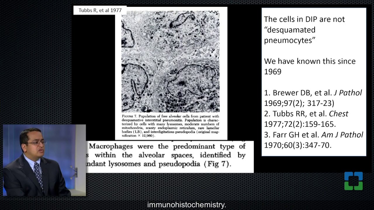 Pathology Insights: Smoking-Related Interstitial Fibrosis with Sanjay Mukhopadhyay, MD