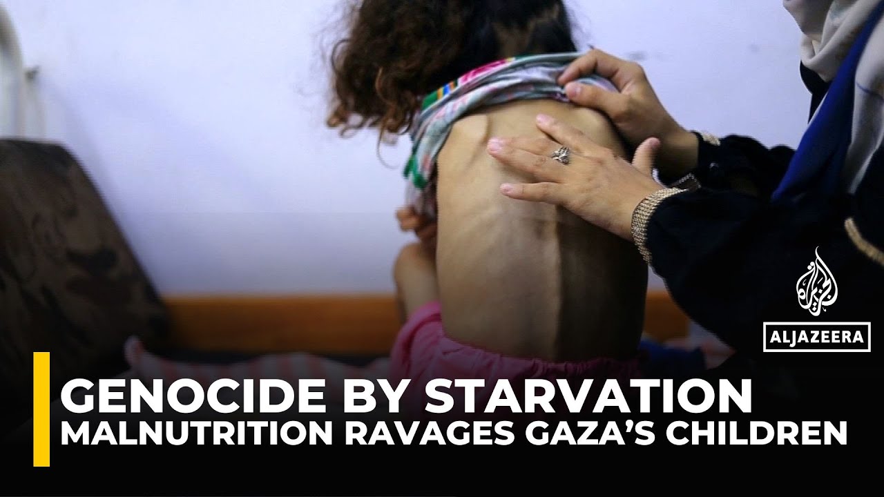 Severe malnutrition grips Gaza&rsquo;s children as blockade seals borders