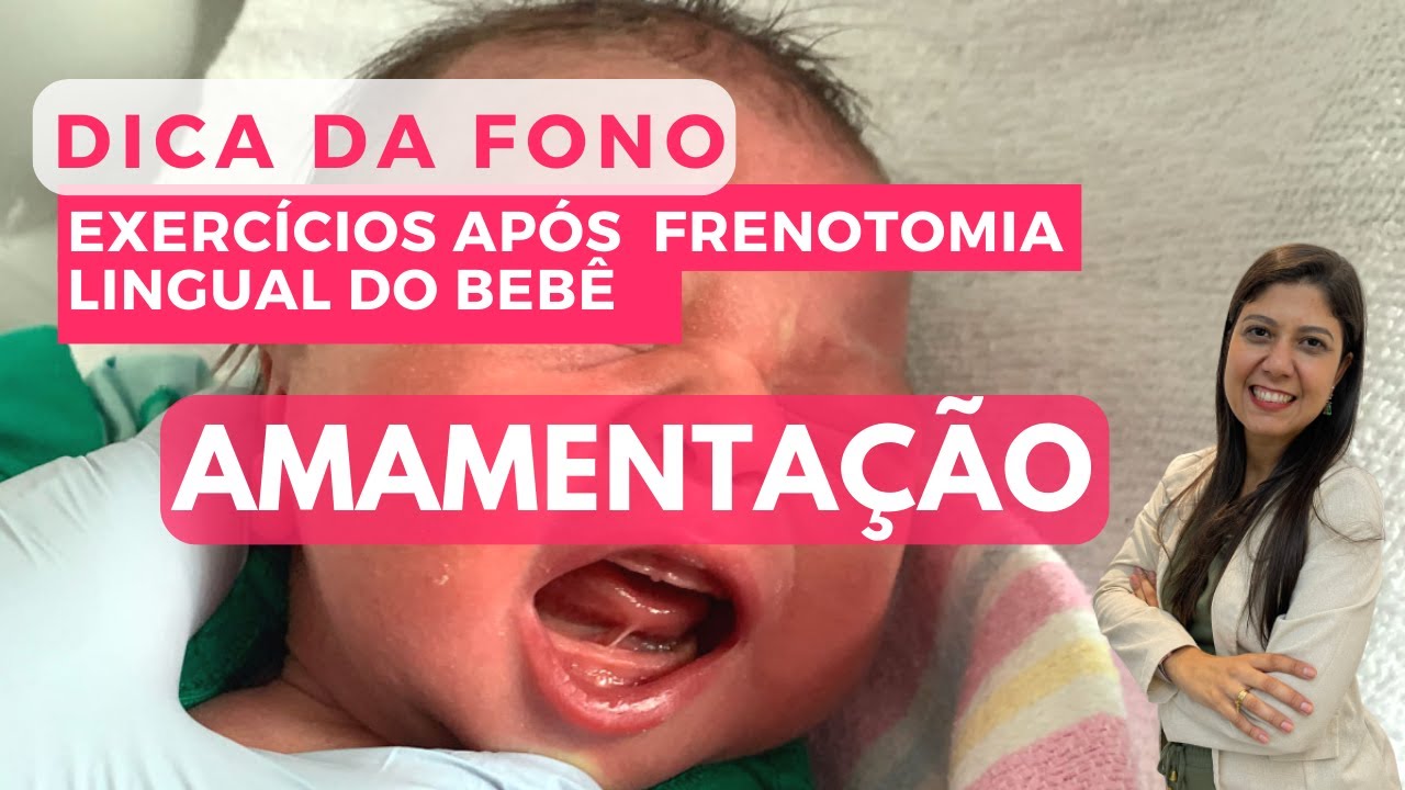 Dica da Fonoaudióloga- exercícios após frenotomia lingual do bebê - Amamentação