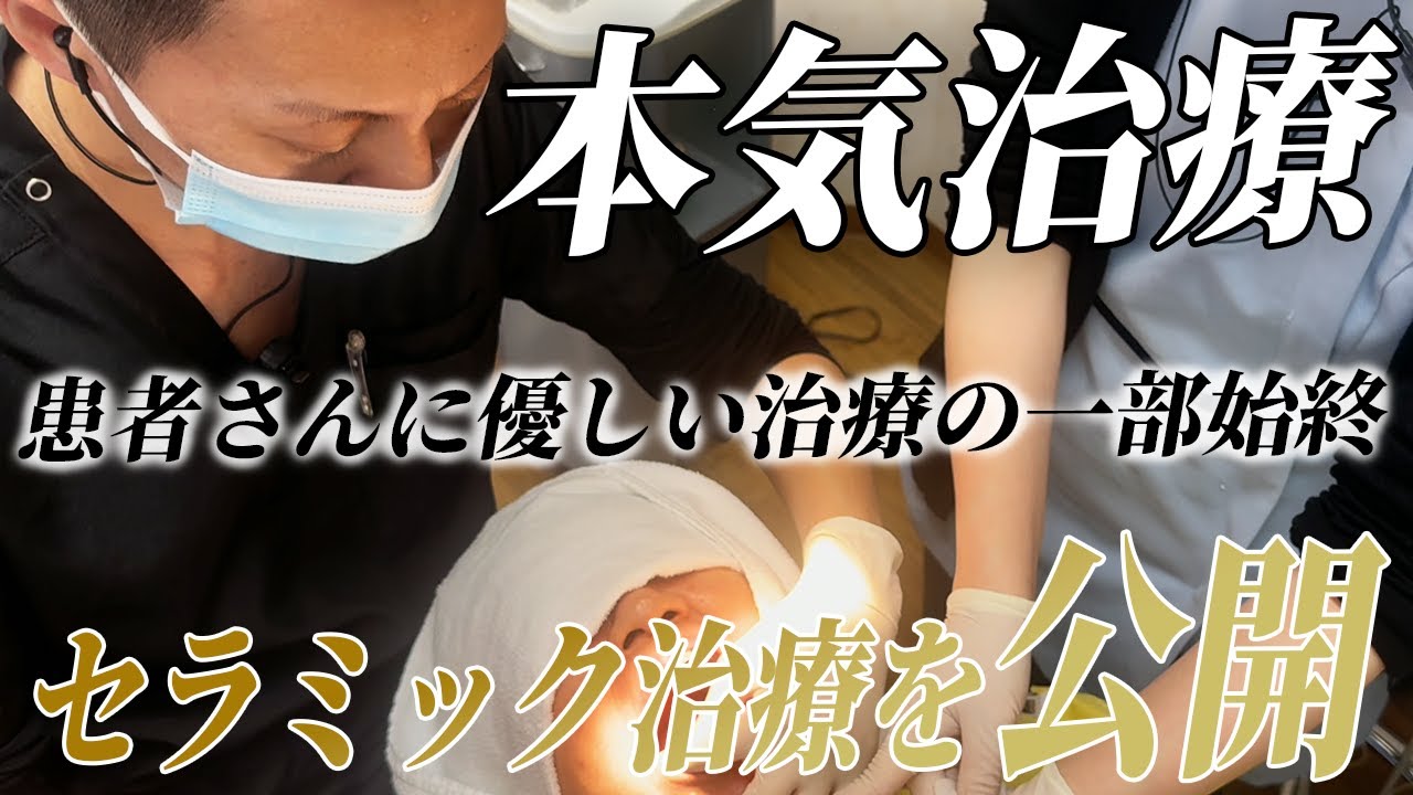 【治療動画】芦屋市の歯学博士ひだっちのセラミック治療を公開！
