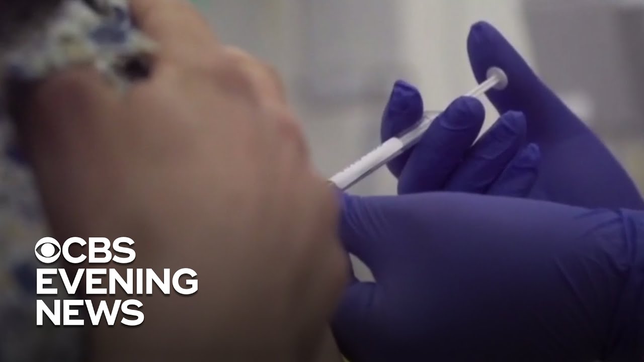 Moderna coronavirus vaccine begins phase 3 trial with 30,000 participants
