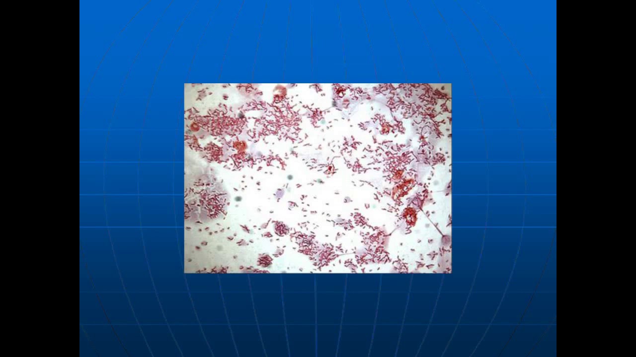 Campylobacter Enteritis and Laboratory Methods for Its Diagnosis  Is There a Best Way