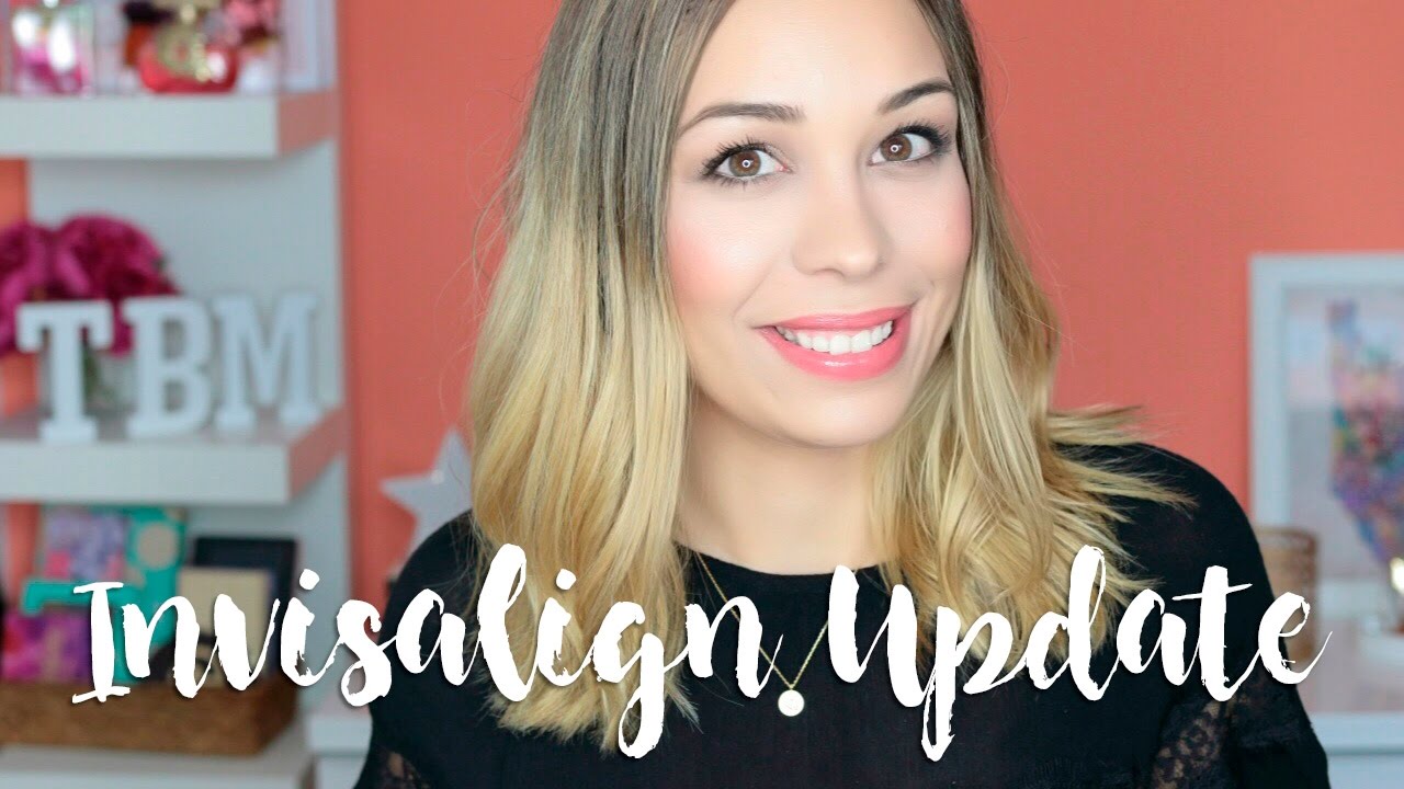 Invisalign Update! IV | Monica TBM
