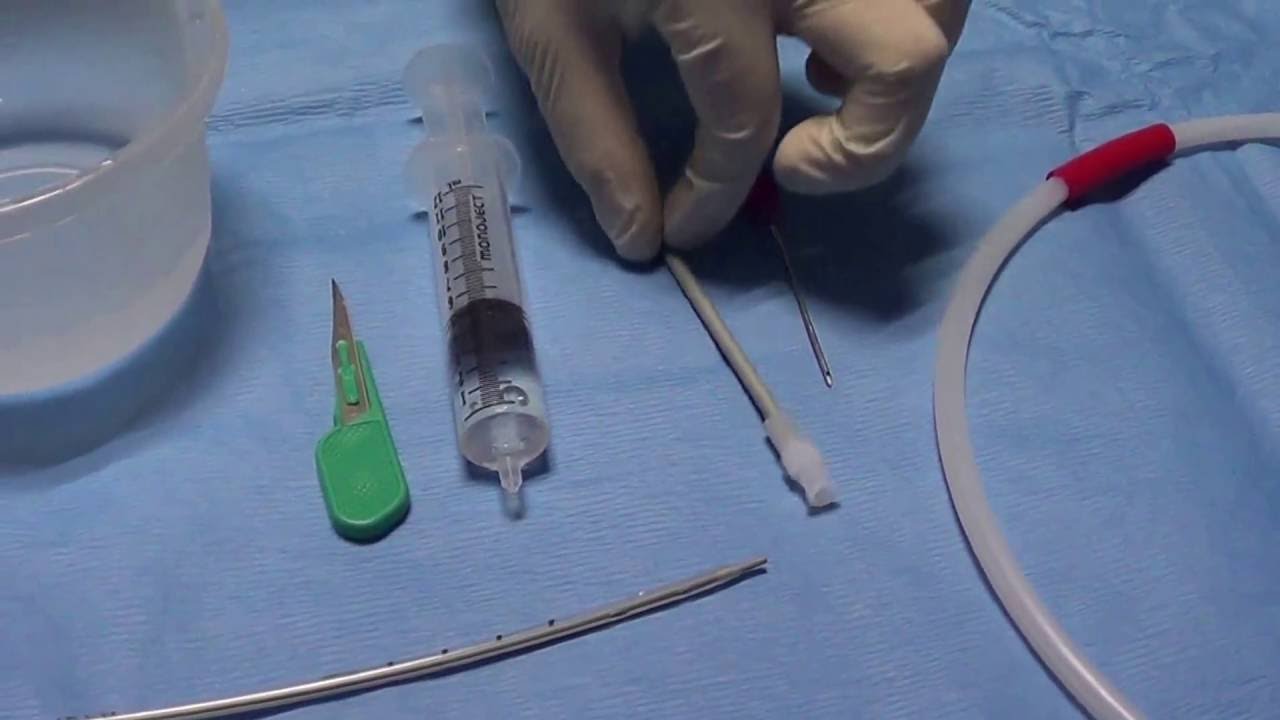 Catéter Intercostal por Seldinger