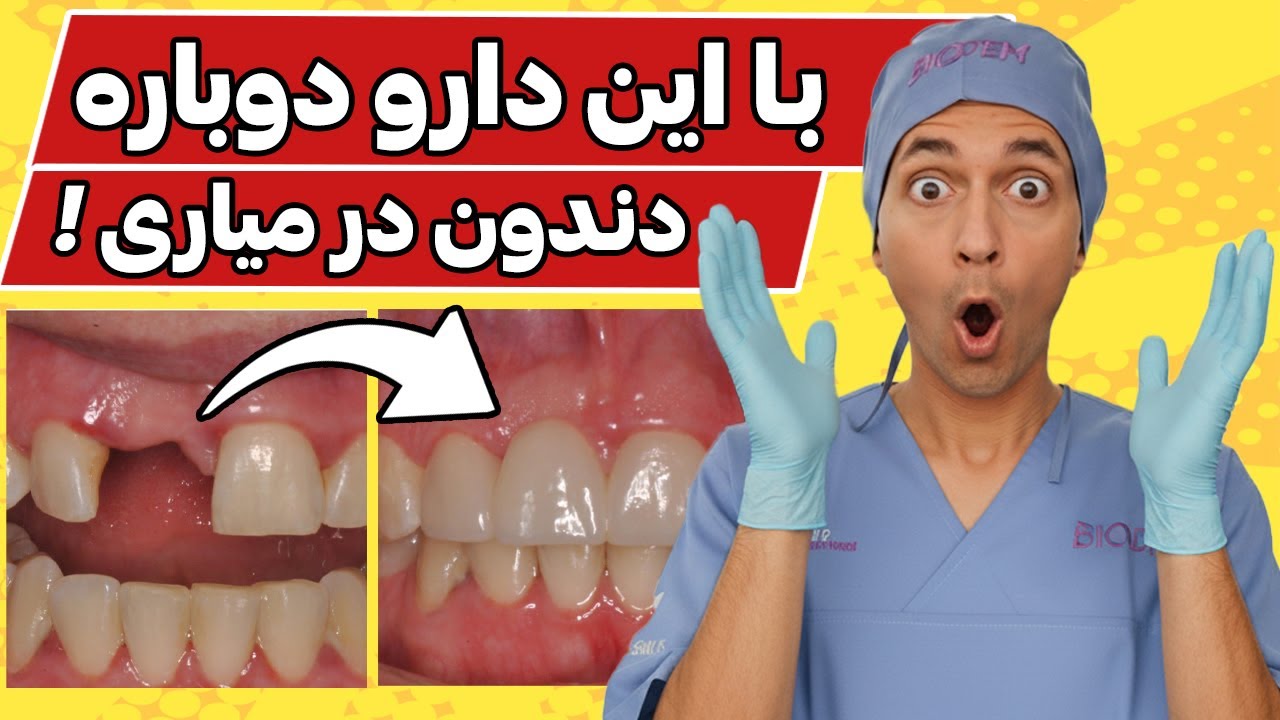 !!! دیگه به ایمپلنت احتیاج نداری ! با این دارو دوباره دندون درمیاری