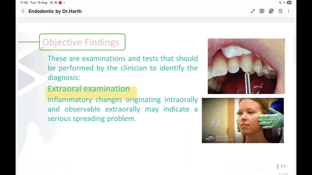 Endodontic Diagnosis |endodontic|fifth stage 