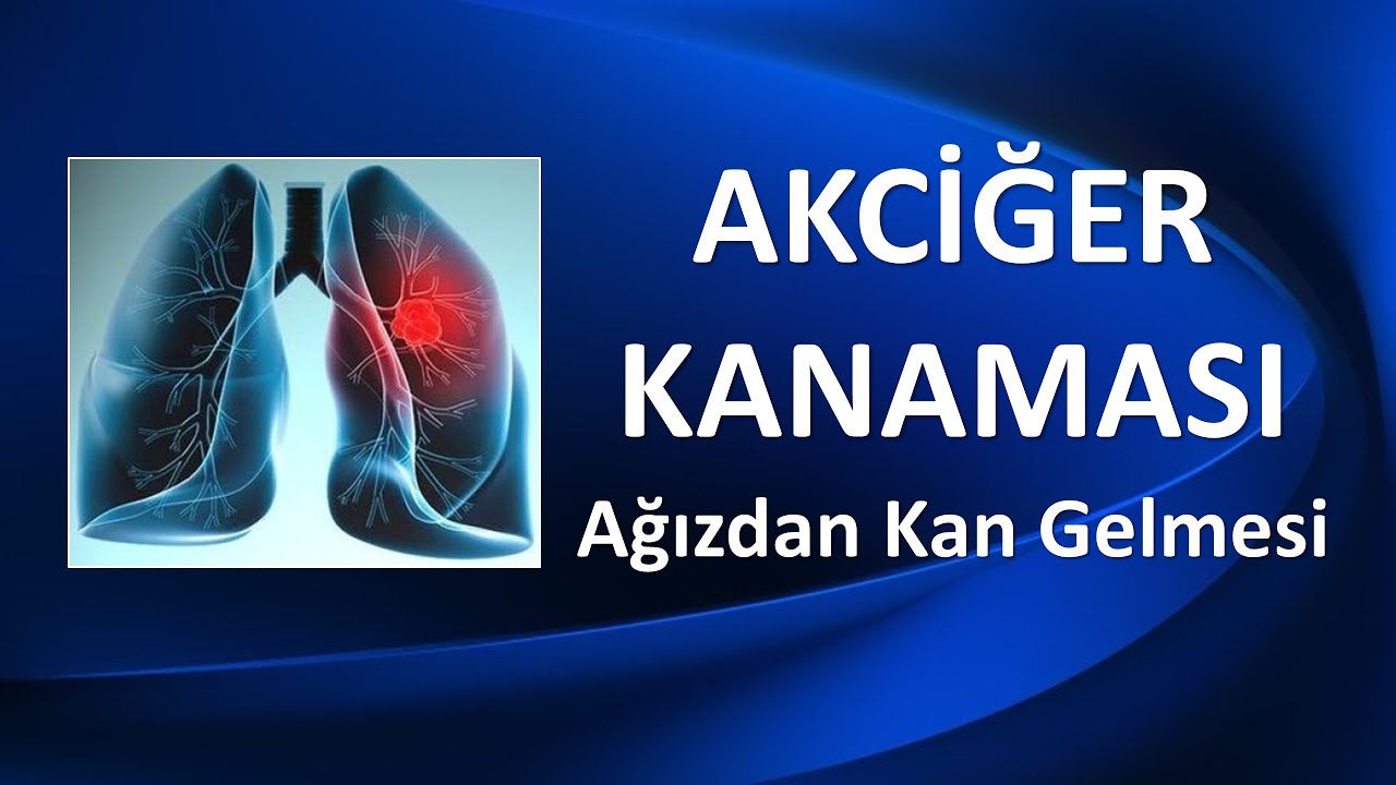 AKCİĞER KANAMASI /AĞIZDAN KAN GELMESİ
