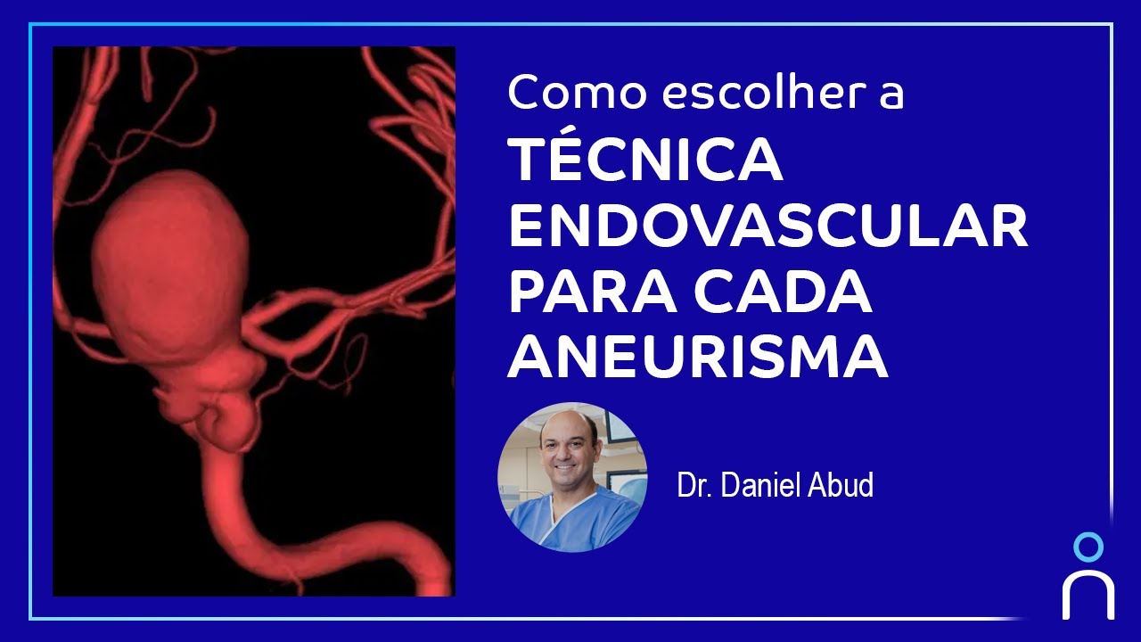 Como Escolher a Técnica Endovascular para Cada Tipo de Aneurisma - com Dr. Daniel Abud