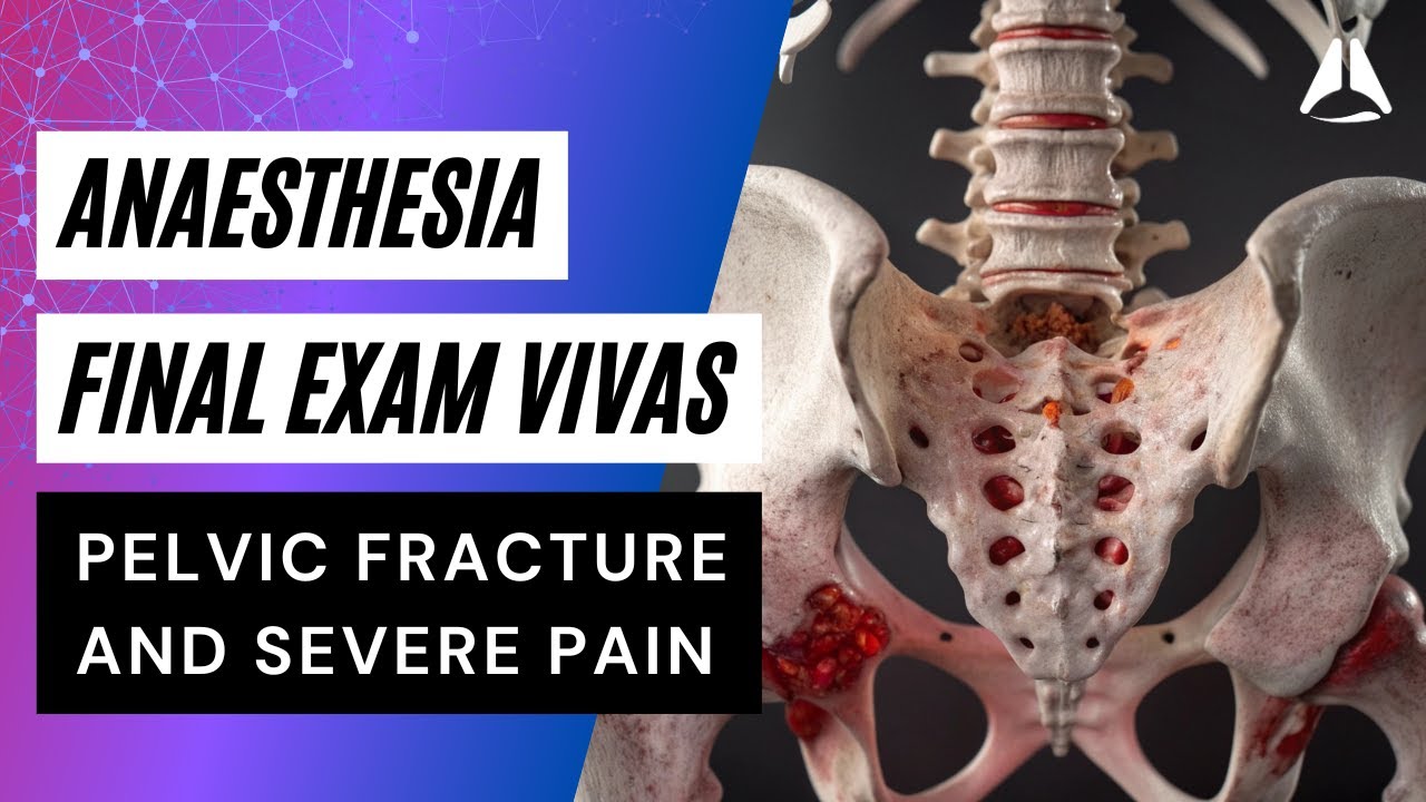 Final Exam Viva - Pelvic Fracture with Severe Pain Risk | #anaesthesia #anesthesiology