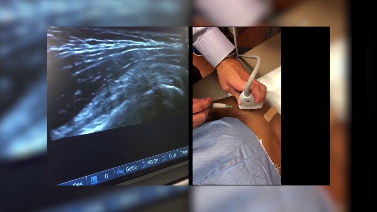 Dr. Christopher Baker, Injections with and without Ultrasound - Florida Orthopaedic Institute