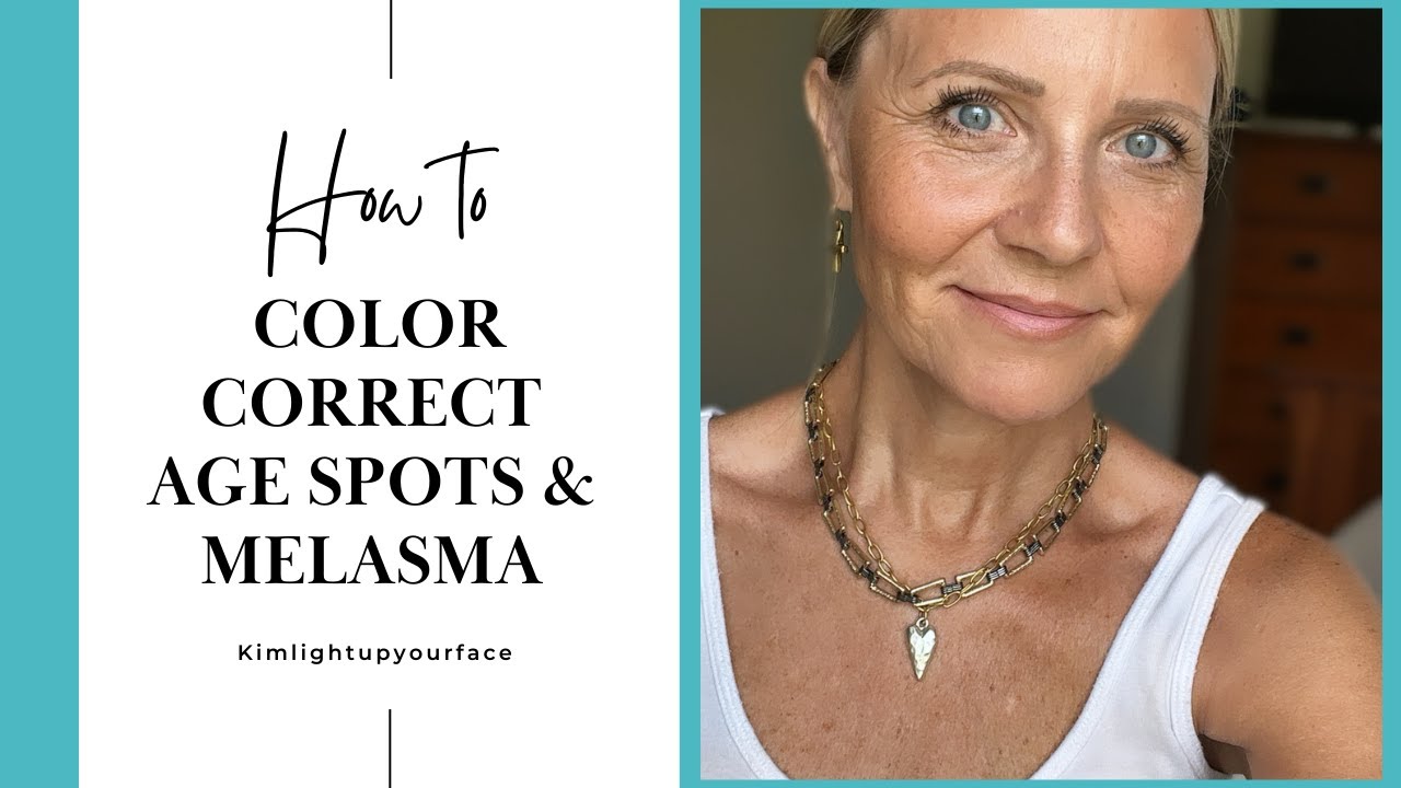 Color Correction- Age Spots & Melasma