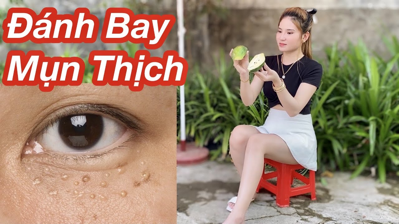Mụn Cơm, Mụn Thịch Biến Khỏi Cơ Thể Bạn Nếu Làm Theo Cách Này/ Cách Trị Mụn Thịch Mụn Cơm Siêu Nhanh