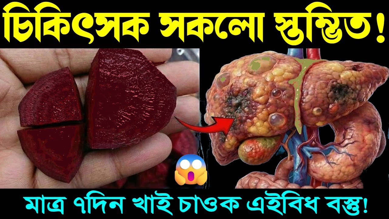 মাত্ৰ ৭দিন খাই চাওক এইবিধ বস্তু! চিকিৎসকো স্তম্ভিত! Chukandar | Beetroot | Health Tips