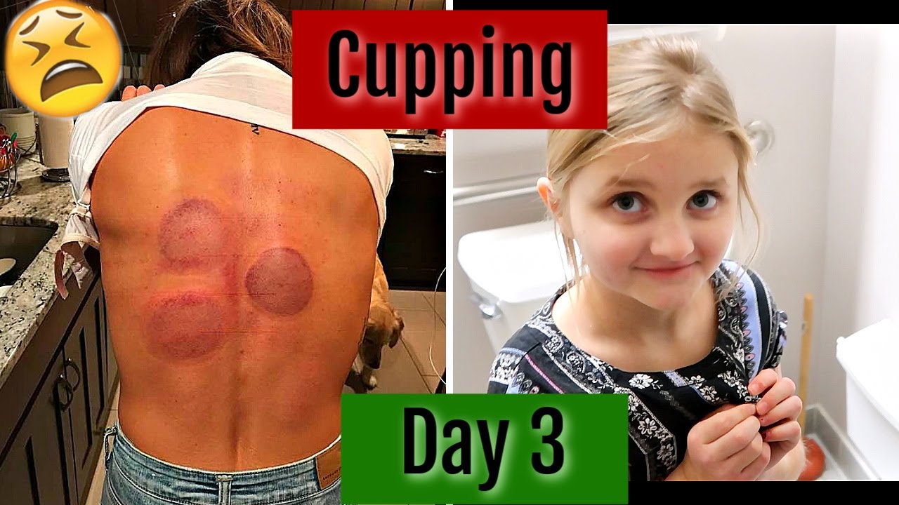 CUPPING & OMNIPOD FAIL | VLOGMAS DAY 3 |