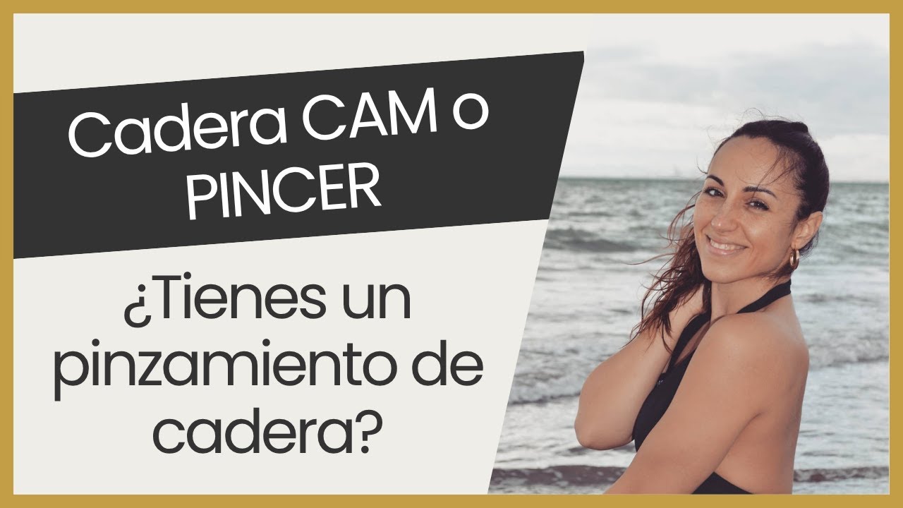 El pinzamiento de cadera. Qué es una cadera CAM o PINCER