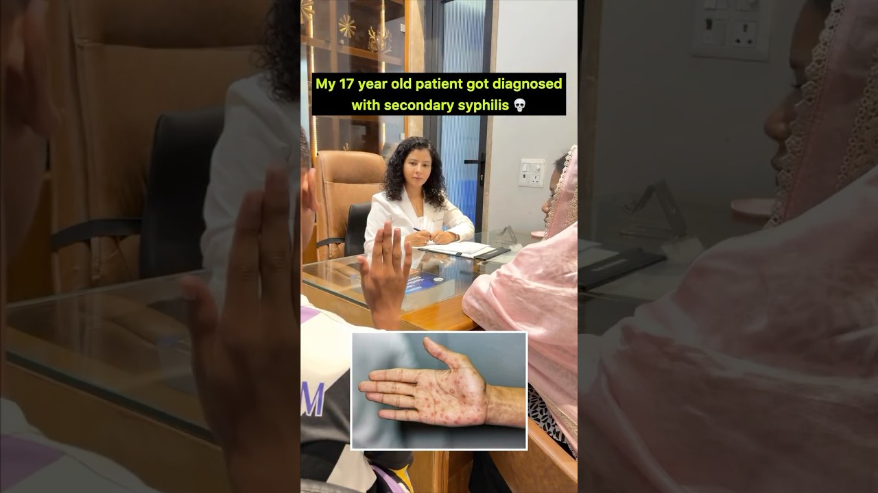 My 17 year old patient got diagnosed with secondary syphilis 😷