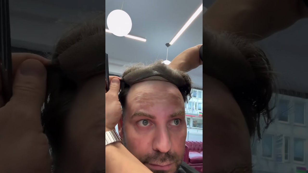 A hairline that&rsquo;s second to none! 💯|  LaVivid Hair System