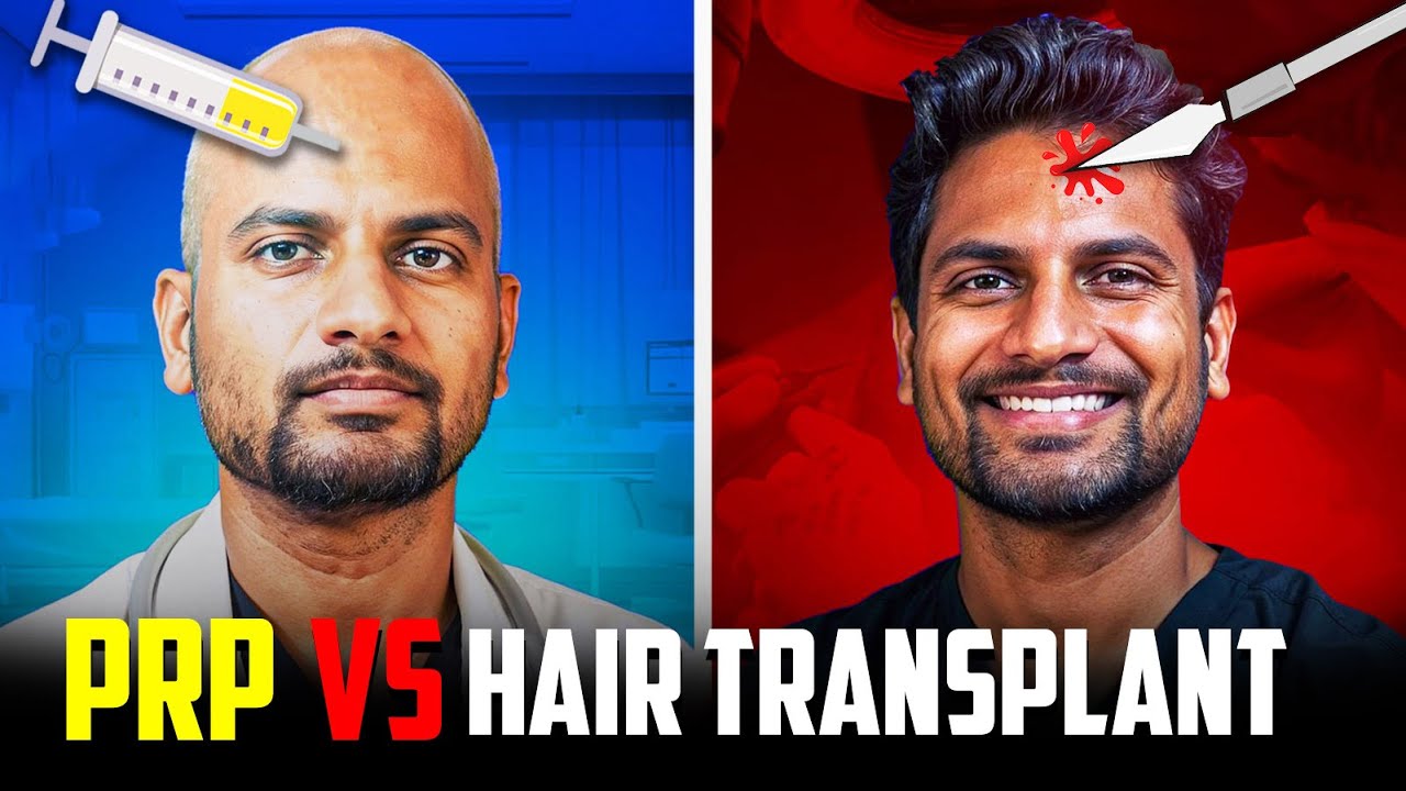 PRP Vs Hair Transplant - இது இரண்டுல எது Best? 🤔