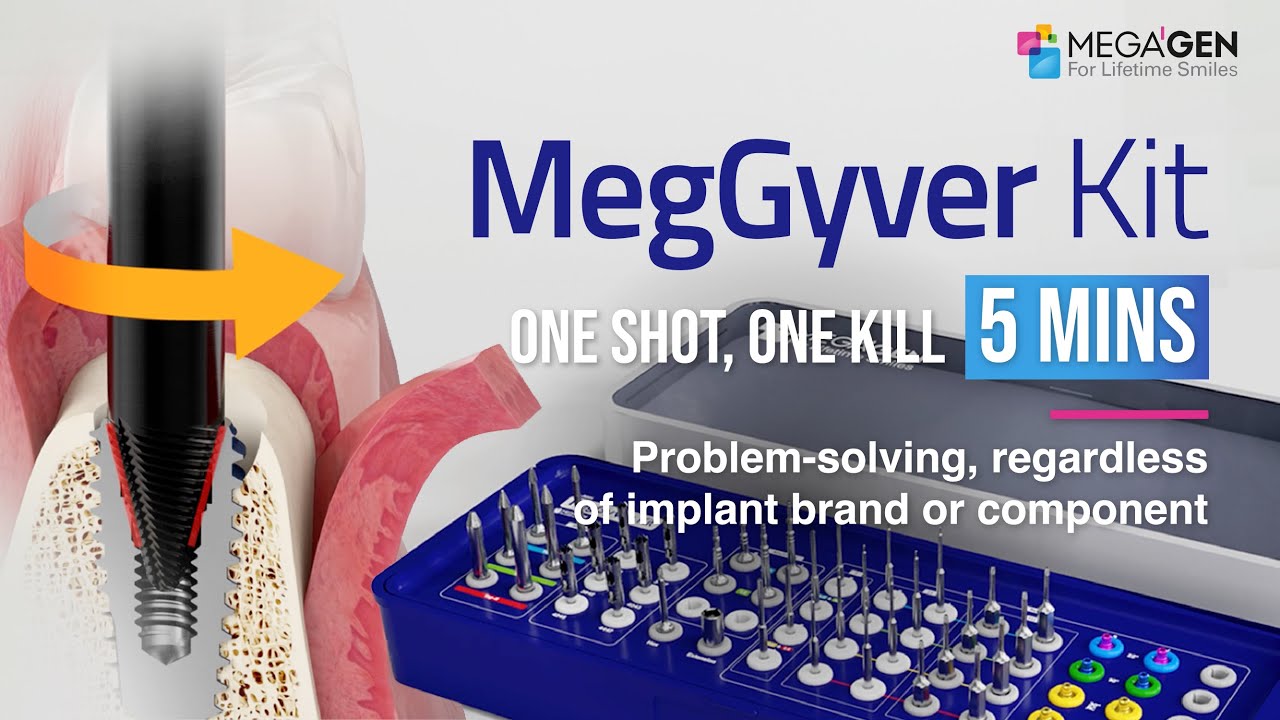 MegGyver Kit, the perfect solution kit for any emergency cases 🛠️