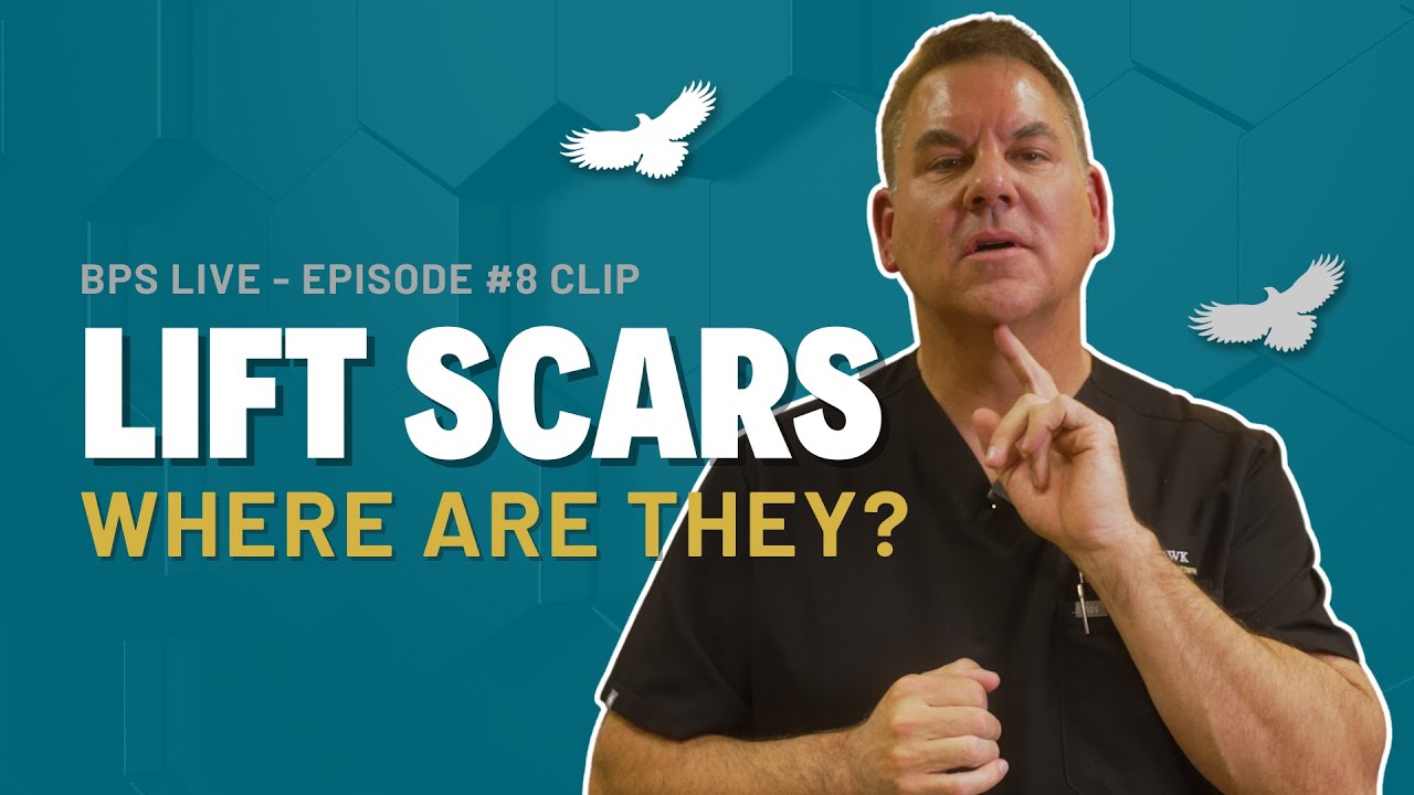 🔍 Where Are Facelift Scars Hidden? Dr. Ronan Explains the Short-Scar Technique