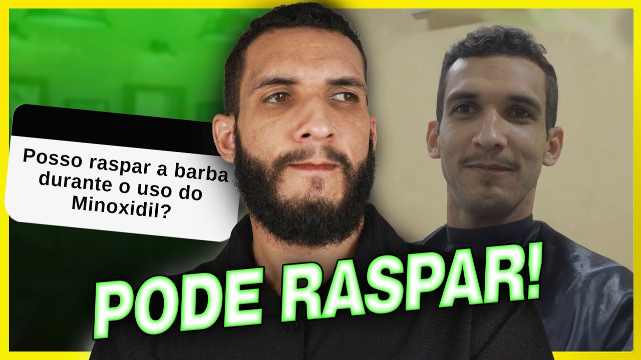 Posso raspar a barba durante o tratamento com Minoxidil? (respondendo perguntas)