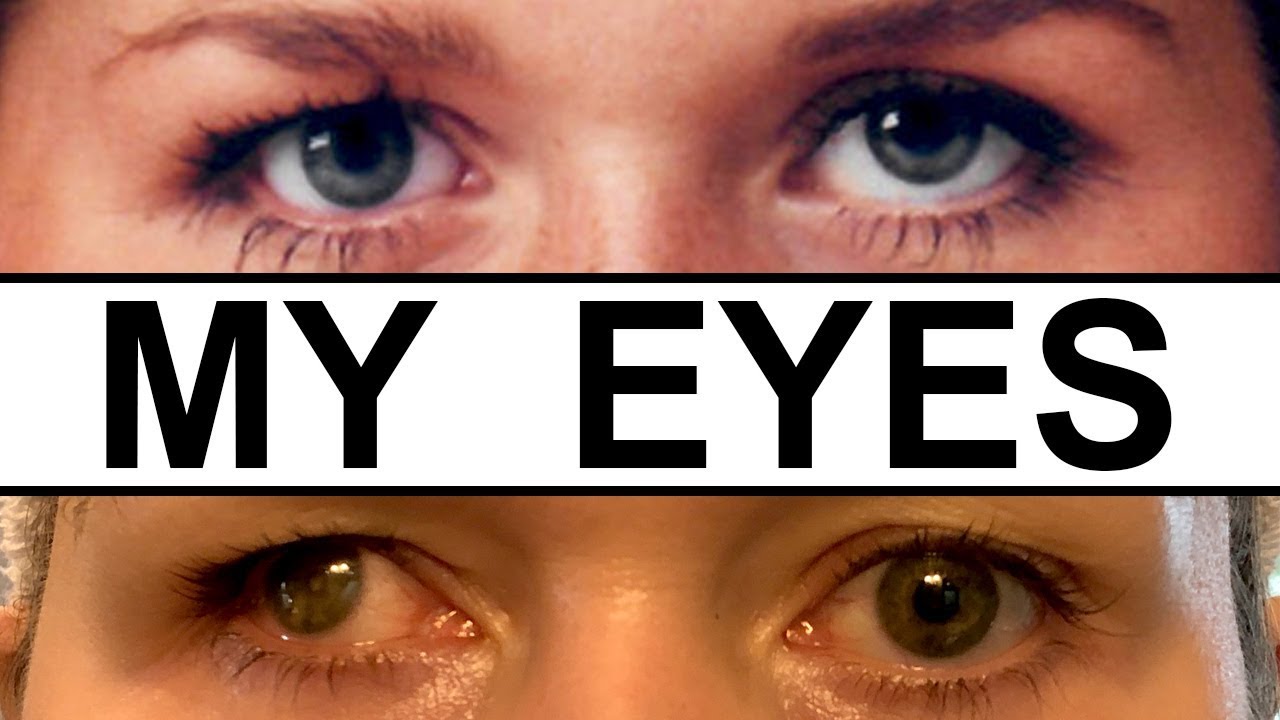 Tips and Tricks to Camouflage a Small, Droopy, Lazy, & Blind Eye