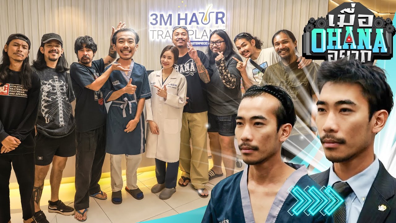 เมื่อ OHANA อยาก : พาแต้มไปแก้หัวล้าน 3M Hairtransplant