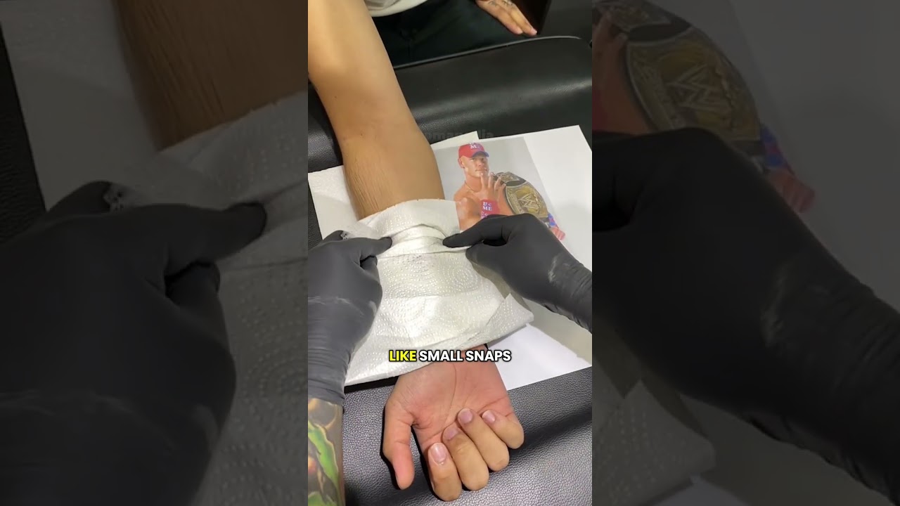 Is Hot Laser Tattoo Removal REALLY Effective? 