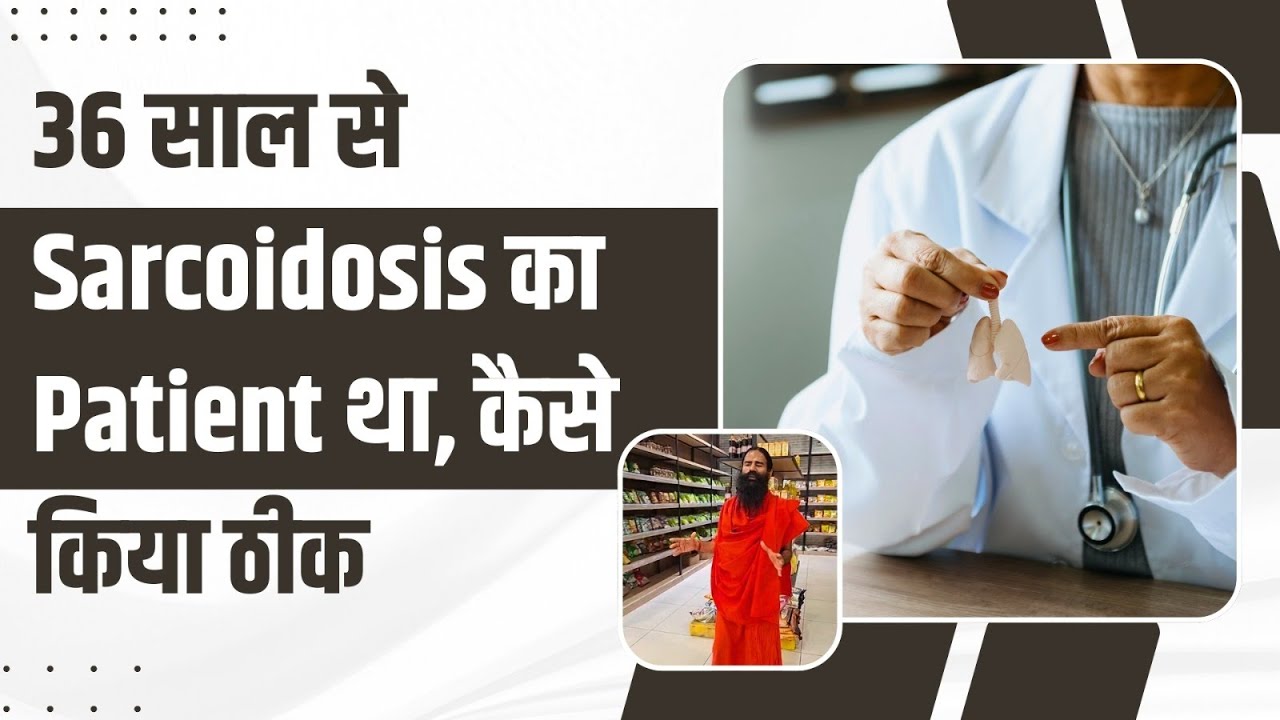 36 साल से Sarcoidosis का Patient था, कैसे किया ठीक || Swami Ramdev