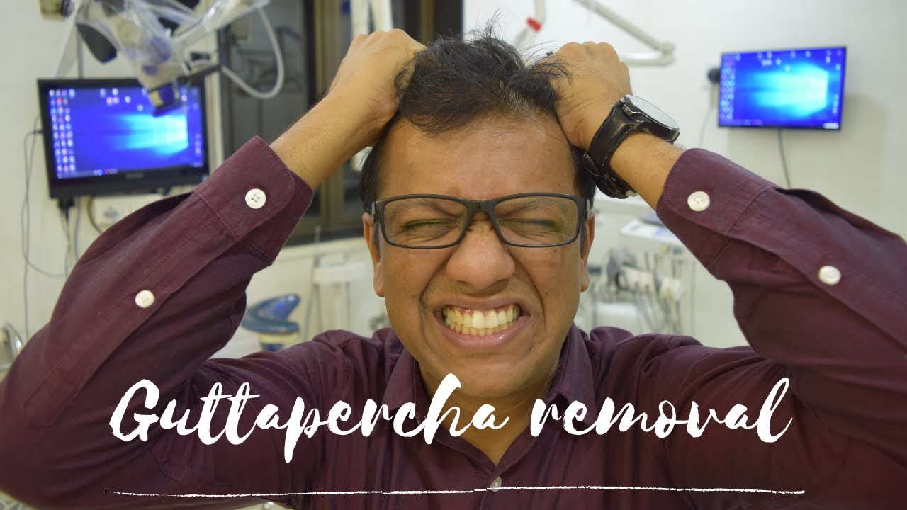 Gutta-percha Removal | Easy technique to remove gutta-percha in retreatment cases