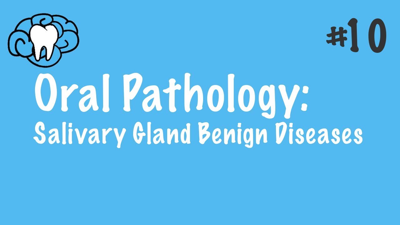 Oral Pathology | Salivary Gland Benign Diseases | INBDE, ADAT