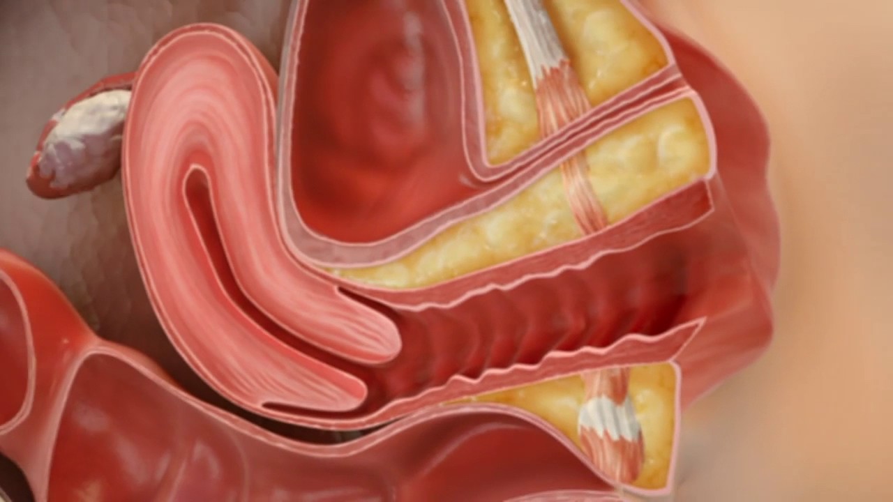 Sparkle Lifestyle & Medispa - CO2RE Intima