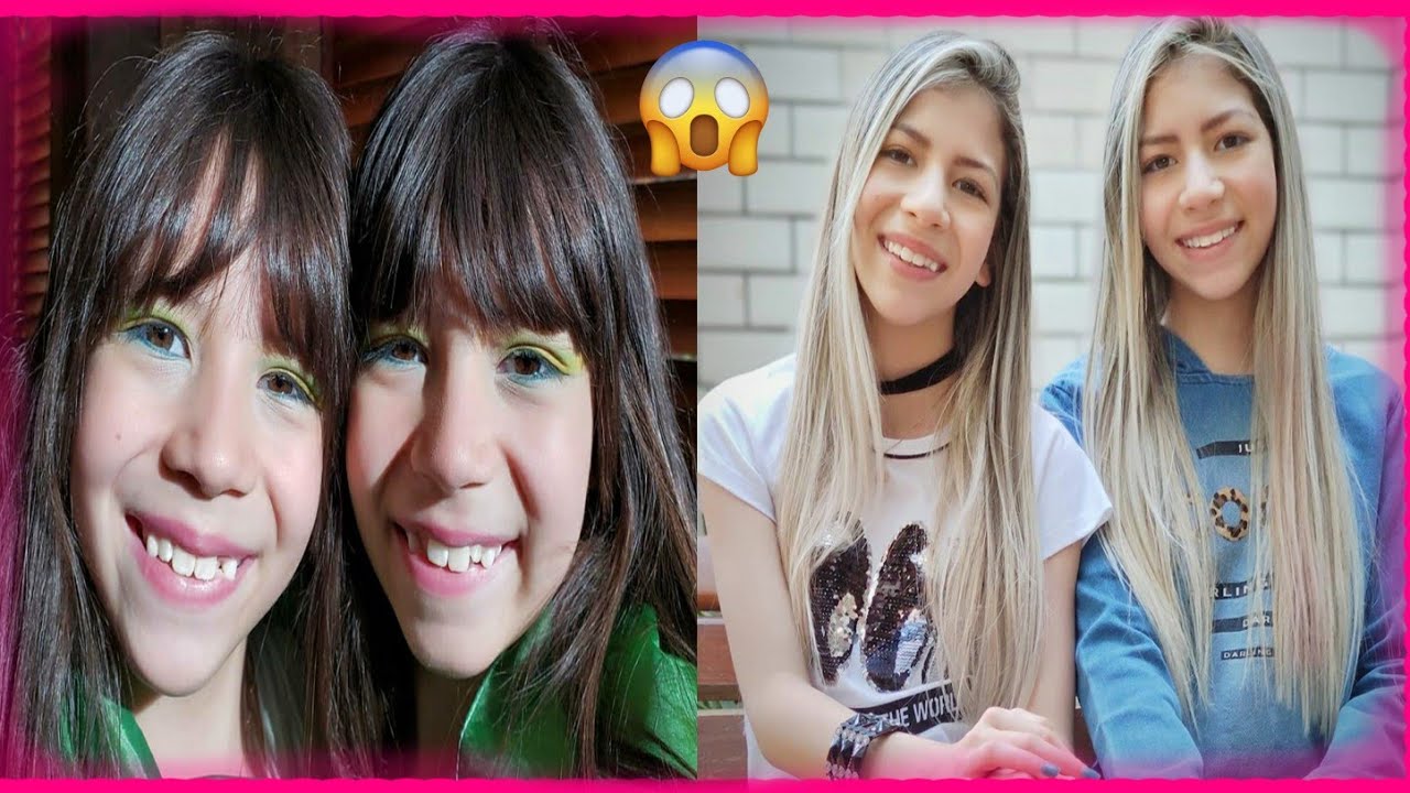 Antes e Depois do Planeta das Gêmeas *Desenvolvimento de Melissa e Nicole*