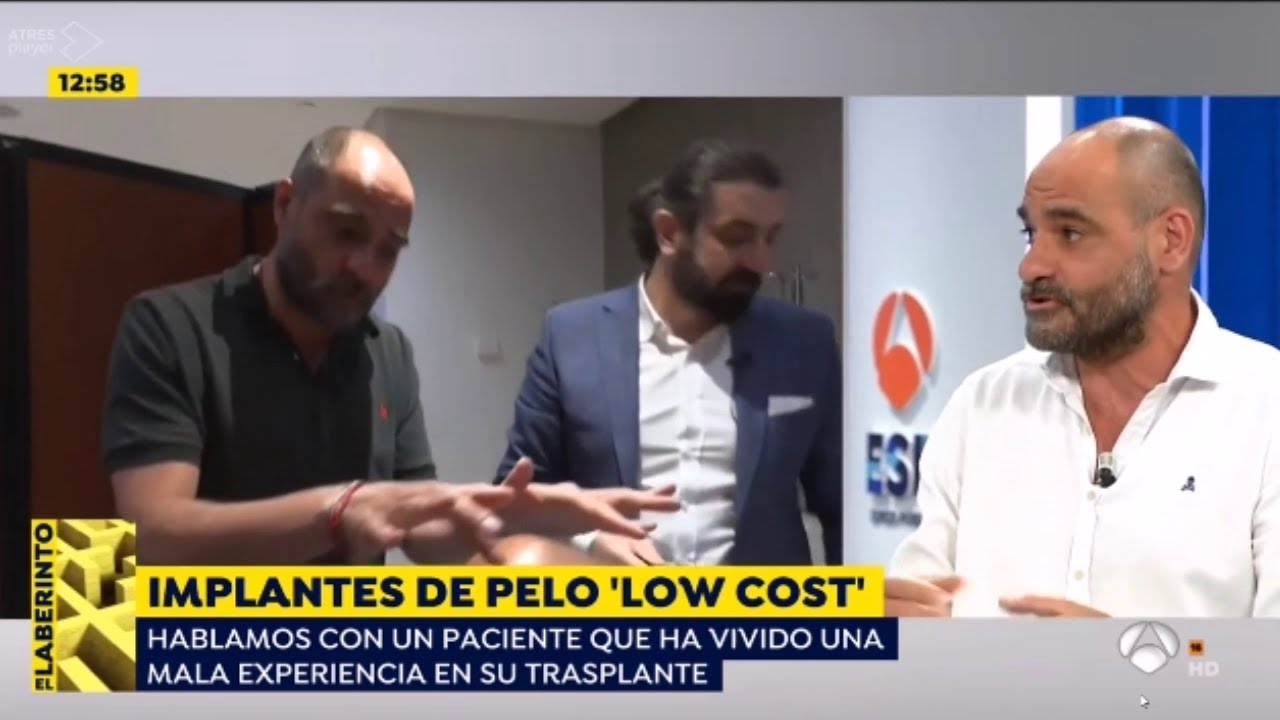 Trasplante capilar en Turquía. 👉¿Cómo elegir una buena clínica? 【Dr Cinik】