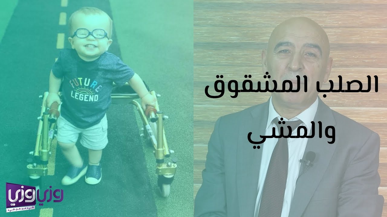 الصلب المشقوق والمشي