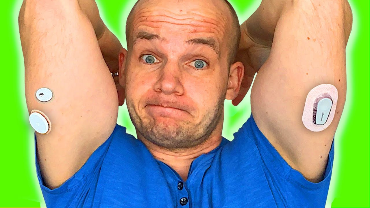 FreeStyle Libre vs Dexcom | Which is ACTUALLY Better