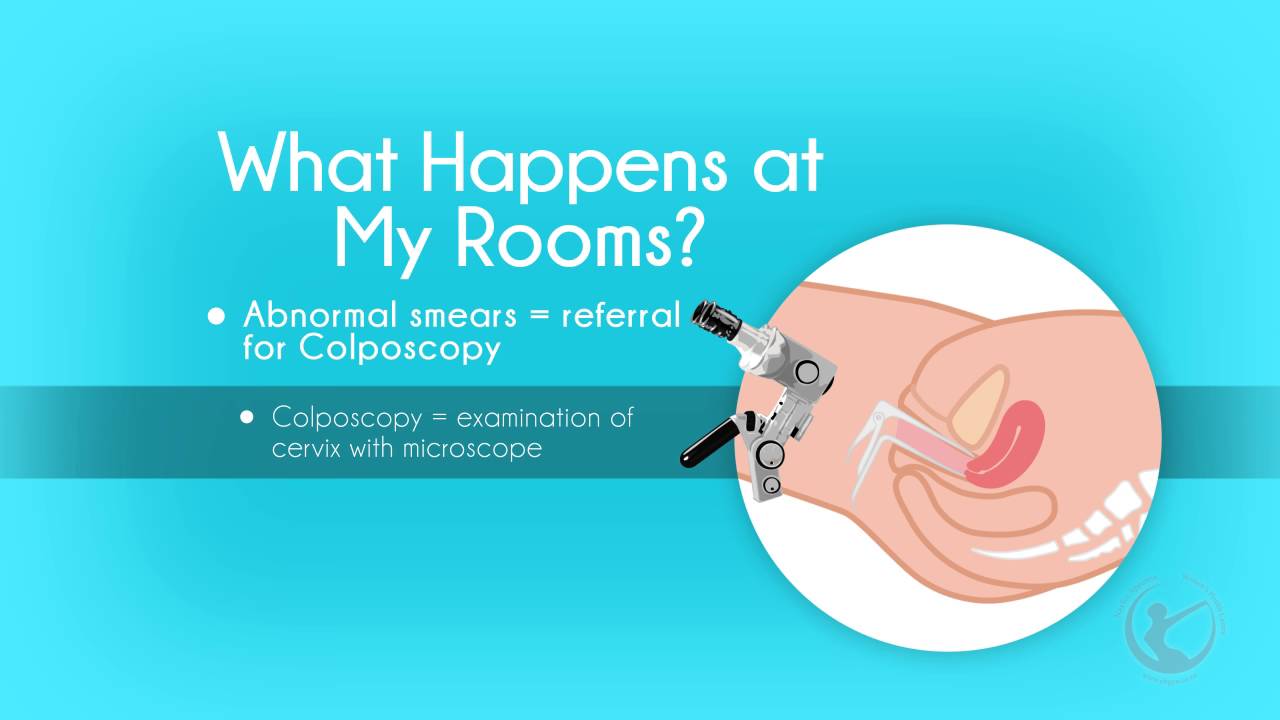 Cervical Smear Abnormalities and Colposcopy