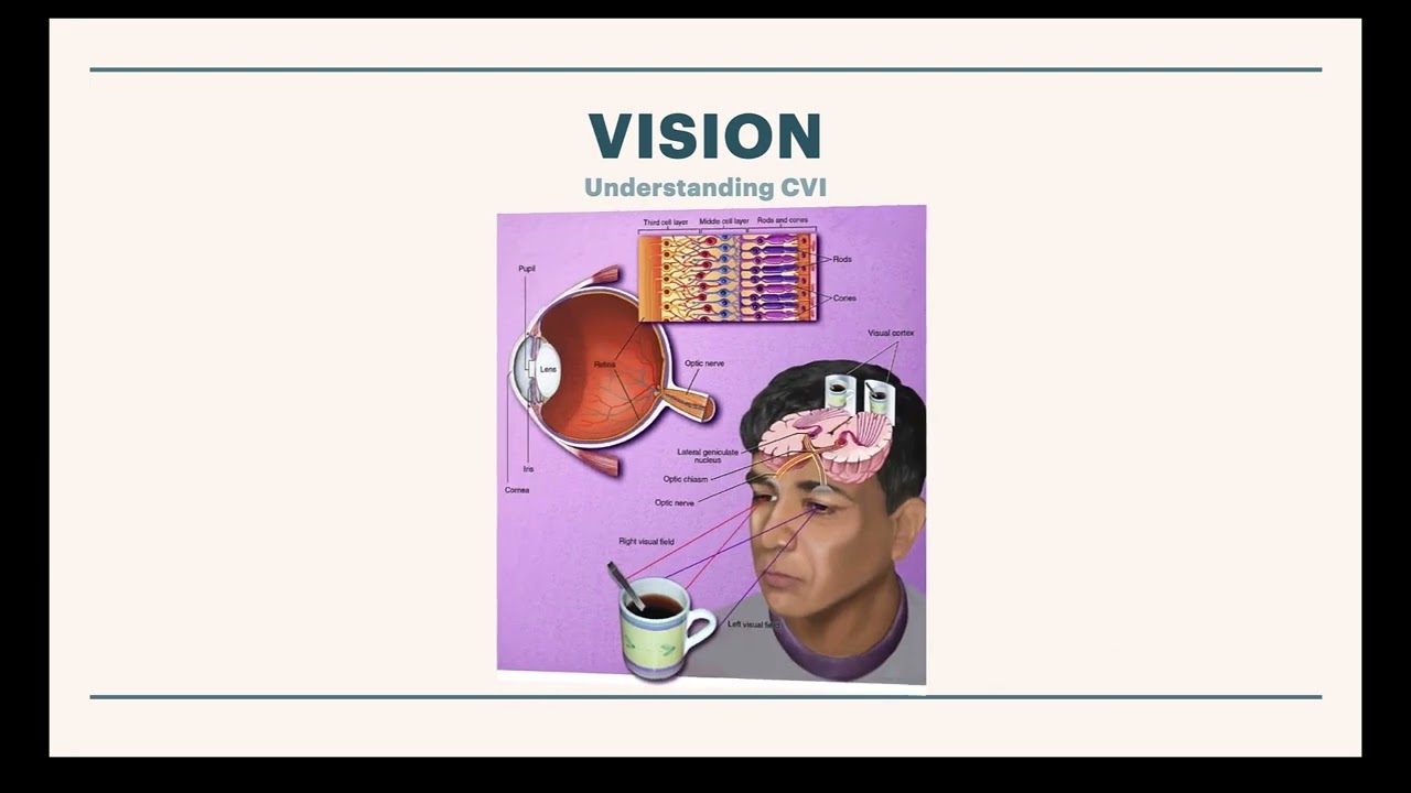 CViConnect PRO – Identifying CVI (Cortical Visual Impairment)