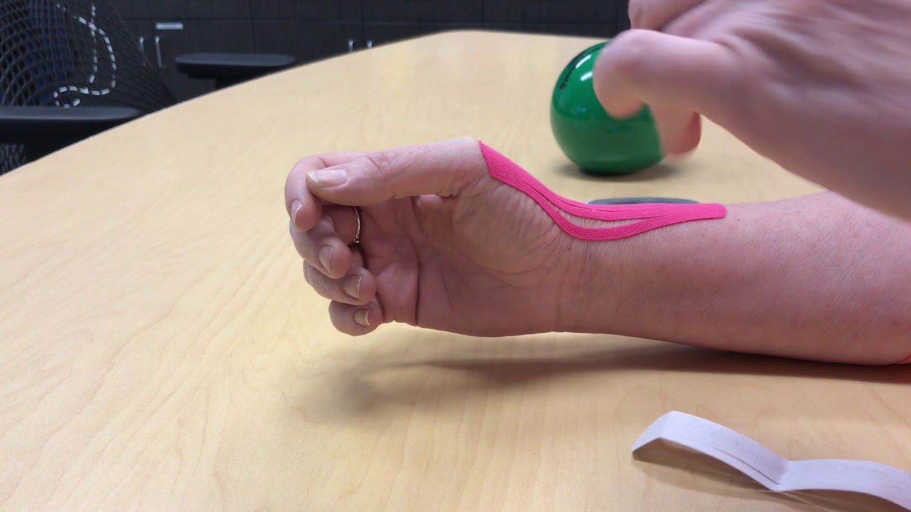 THUMB AND RADIAL SIDED WRIST PAIN