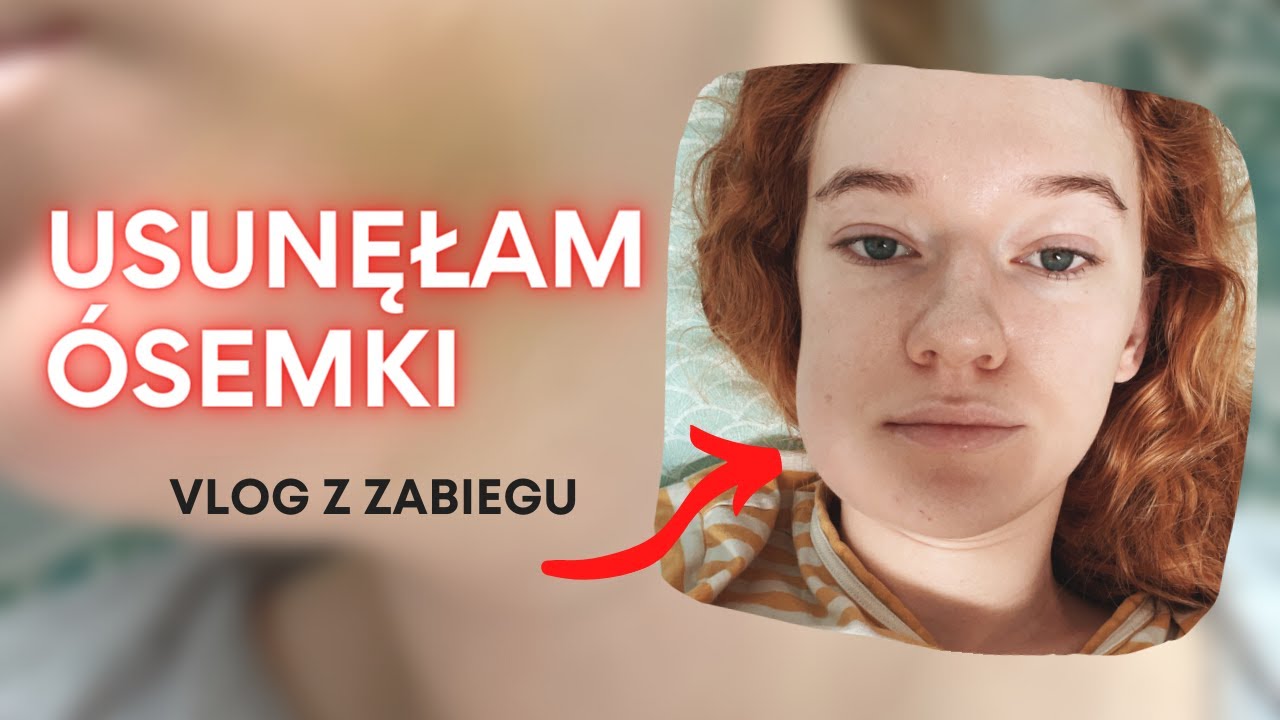 USUNĘŁAM ÓSEMKI | RELACJA DZIEŃ PO DNIU