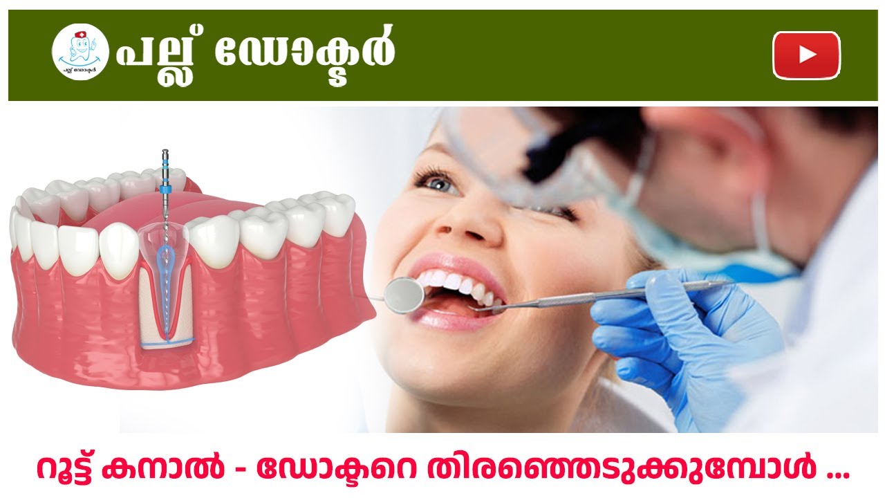 റൂട്ട് കനാൽ - ഡോക്ടറെ തിരഞ്ഞെടുക്കുമ്പോൾ ...