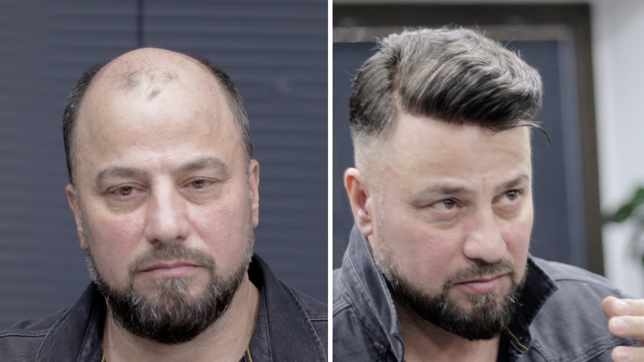 PROTEZ SAÇ İLE HER ZAMAN GENÇ KAL - Hair Replacement
