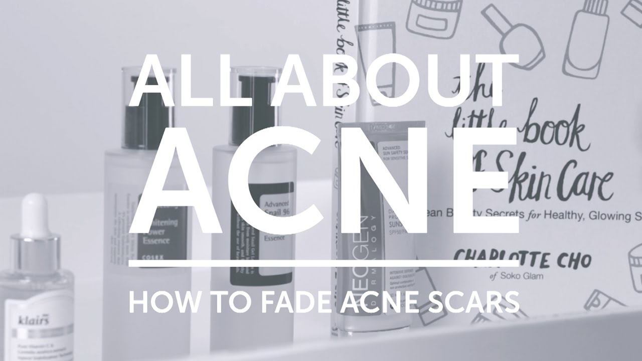 All About Acne: How To Fade Acne Scars with COSRX