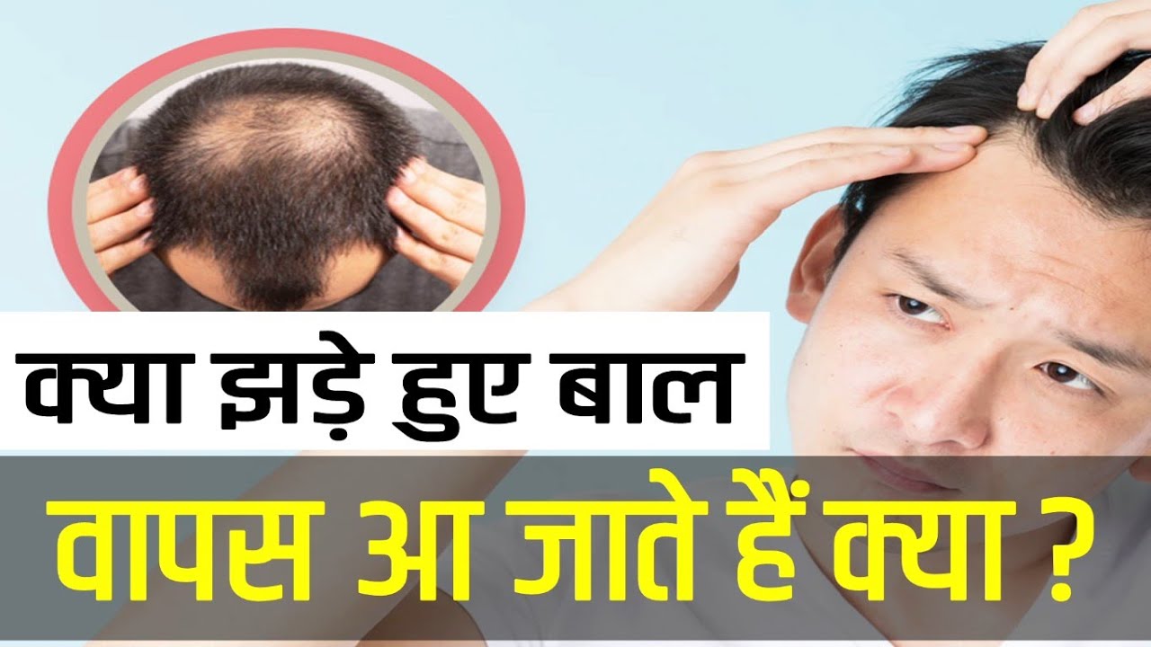 क्या झड़े हुए बाल वापस आ जाते हैं क्या? Do lost hair come back? Types Of Hair Loss!