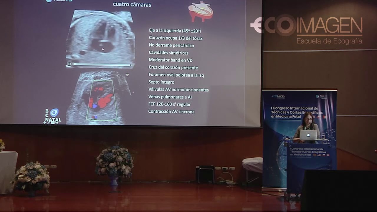 Clase 18 | Ecocardiografía, Principales Patologías Congénitas por la Dra. Fátima Crispi