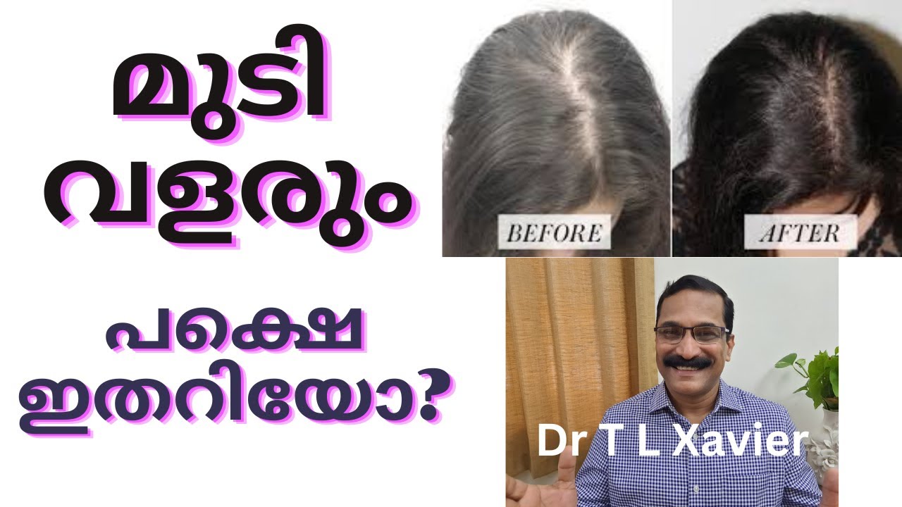 മുടി വളരും || Promote Hair Growth: Best Food Items for Healthy and Strong Hair